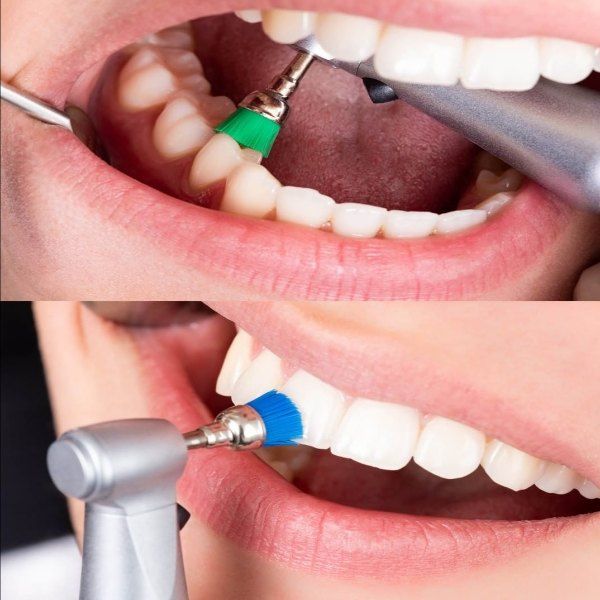 boca abierta con herramientas dentales