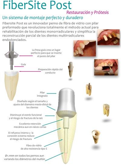 imagen de montaje de dientes